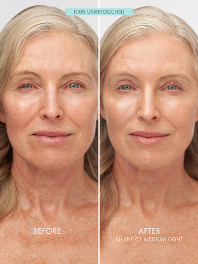 #color_medium-light-02